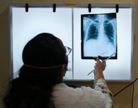 casos-de-tuberculose-aumentam-devido-a-pandemia-de-covid,-diz-oms