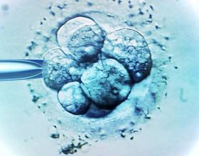 inseminacao-intrauterina,-fertilizacao-in-vitro:-qual-metodo-e-mais-eficaz-e-o-que-esta-disponivel-no-sus?