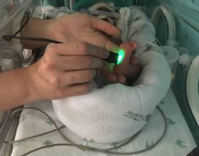 pesquisadores-da-ufmg-criam-aparelho-com-luz-de-led-que-ajuda-a-salvar-bebes-prematuros